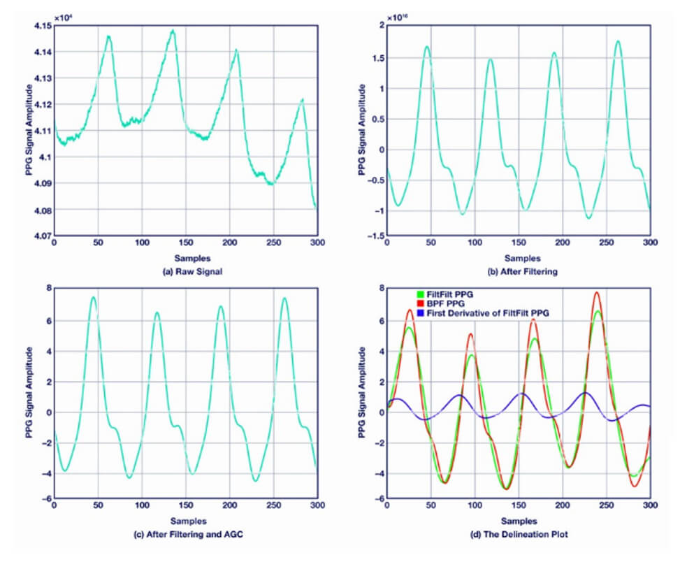図4　PPG信号とその処理過程