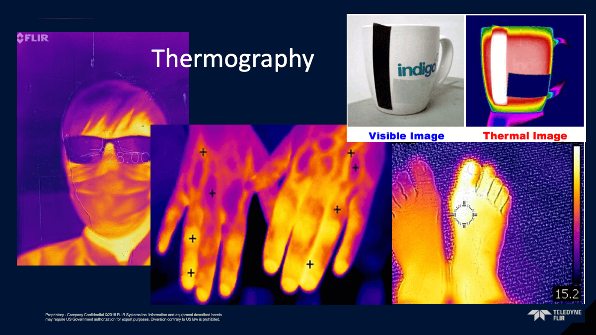 Thermography