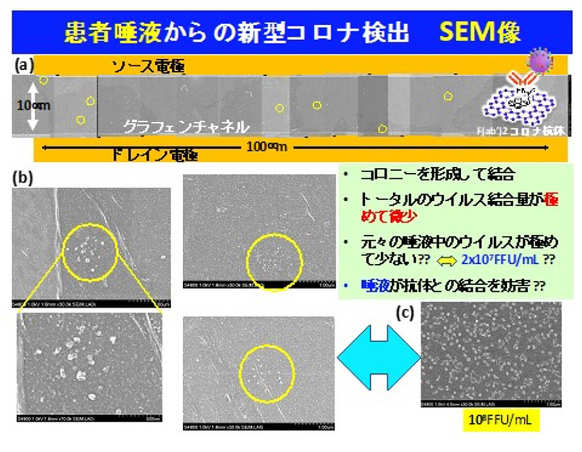 図12. 新型コロナウイルス感染患者の罹患時の唾液を導入したグラフェンFET上のSEM写真。